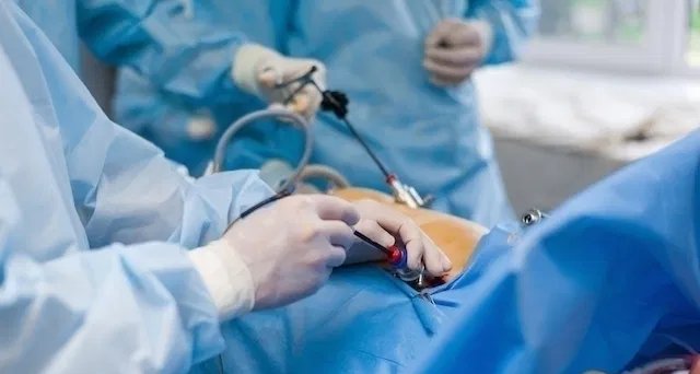 Cirurgia de vesícula: procedimentos, indicações e recuperação - Imagem do artigo