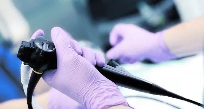 Endoscopia digestiva avalia esôfago, estômago e duodeno e exige jejum de até 12 horas - Imagem do artigo