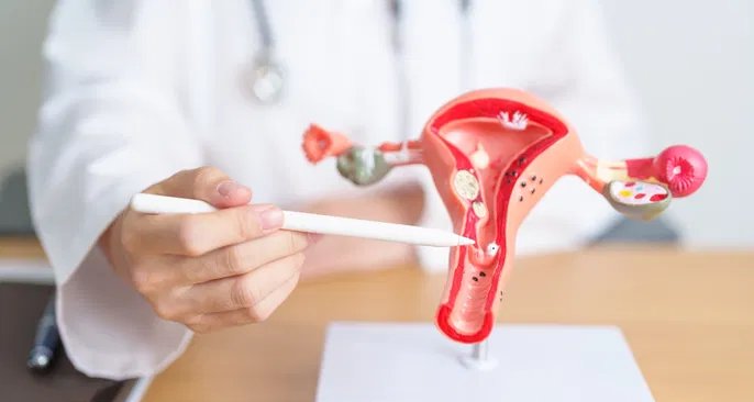 Histerectomia laparoscópica: entenda indicações, técnica e recuperação - Imagem do artigo