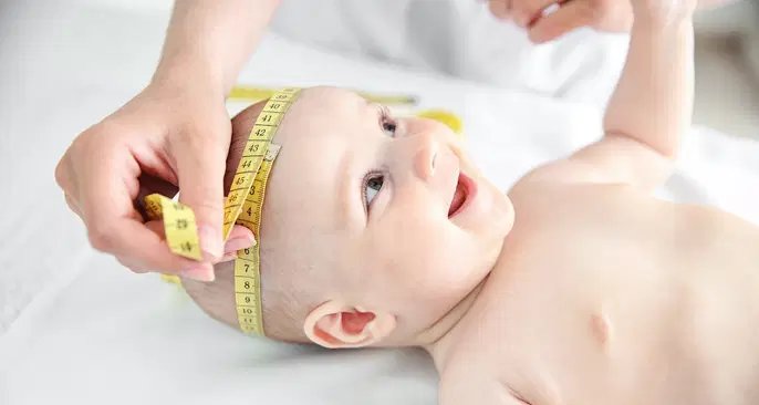 Fechamento precoce das suturas cranianas causa deformidades e pode exigir cirurgia em bebês - Imagem do artigo