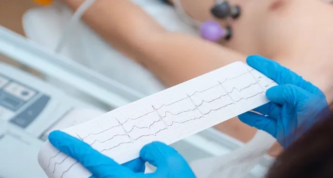 Choque cardiogênico: falha súbita do coração requer socorro imediato - Imagem do artigo