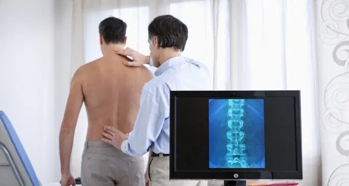 Fratura na coluna pode provocar paralisia e exige diagnóstico rápido, alertam especialistas - Imagem do artigo