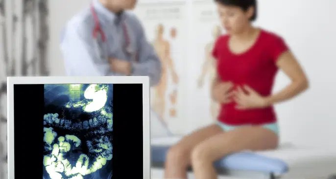 Inflamação do cólon: sintomas, causas, tipos e tratamentos indicados - Imagem do artigo