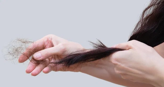Eflúvio telógeno pode triplicar queda de cabelo e costuma regredir em até nove meses - Imagem do artigo
