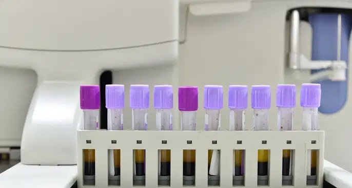 Exame de reticulócitos ajuda a checar atividade da medula óssea e identificar anemias - Imagem do artigo