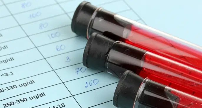 Valores de referência do hemograma para homens, mulheres e crianças - Imagem do artigo