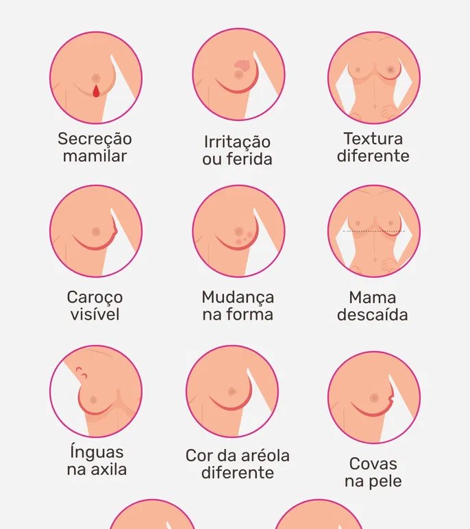 Coceira e outros 11 sinais que podem indicar câncer de mama - Imagem do artigo