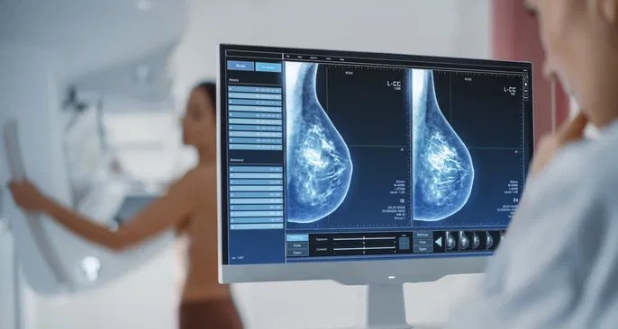 Mamografia digital reduz desconforto e ajuda na detecção precoce do câncer de mama - Imagem do artigo